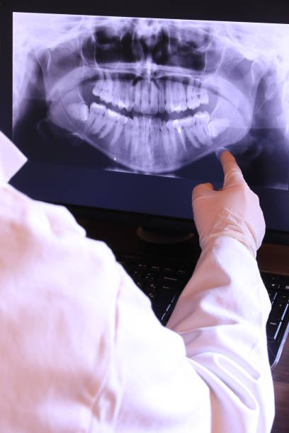 Best Emergency Tooth Extraction in Aberdeen, WA