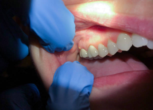 Best Emergency TMJ Treatment in Aberdeen, WA