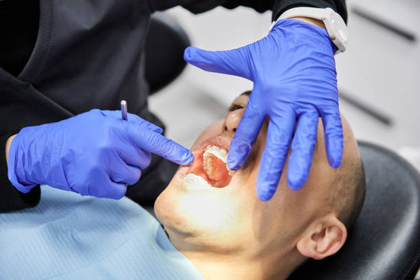 Best Emergency Denture Repair in Aberdeen, WA