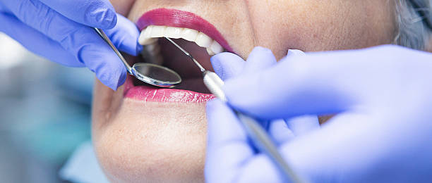 Best Emergency Treatment for Dental Infections or Abscesses in Aberdeen, WA